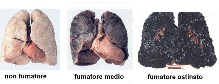Poveri polmoni
